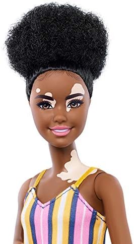 Barbie Fashionistas Doll with Vitiligo